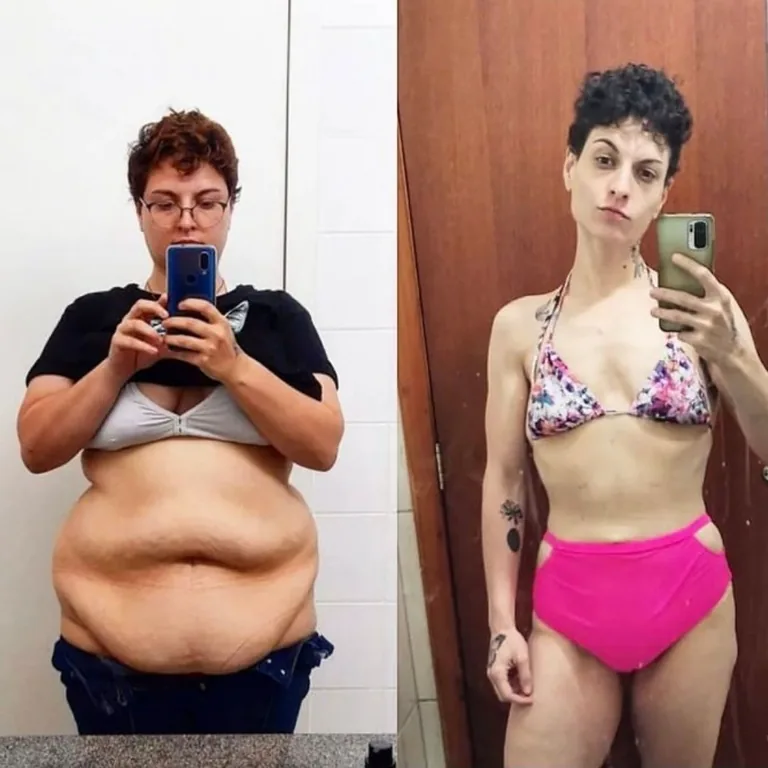 Transformação — 15 meses (−80 kg)